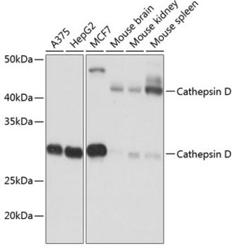 Anti-Cathepsin D Antibody, clone 2B3E8, Rabbit Monoclonal