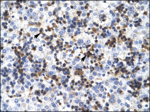 Anti-RUVBL2 antibody produced in rabbit affinity isolated antibody