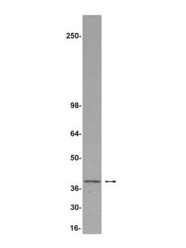 Anti-REA Antibody Upstate&#174;, from rabbit