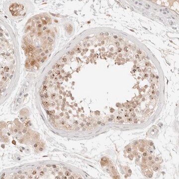 Anti-C17orf47 antibody produced in rabbit Prestige Antibodies&#174; Powered by Atlas Antibodies, affinity isolated antibody, buffered aqueous glycerol solution