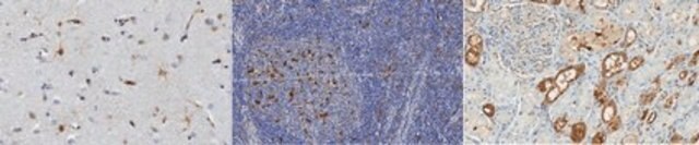 Anti-ZBTB46 (ZNF340) Antibody, clone 5A8.1 clone 5A8.1, from mouse