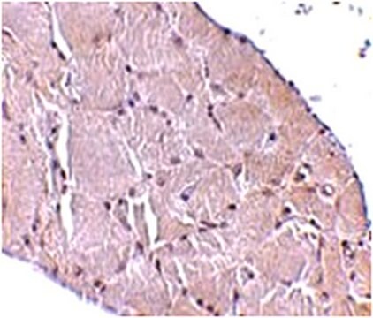 Anti-WNT10A Antibody from rabbit, purified by affinity chromatography