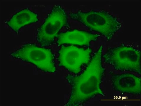 Monoclonal Anti-TIPIN antibody produced in mouse clone 1G11, purified immunoglobulin, buffered aqueous solution