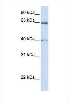 Anti-CACNB2 (ab1) antibody produced in rabbit affinity isolated antibody