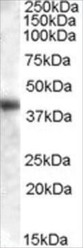 Anti-GOT1 (AA 157-167) antibody produced in goat affinity isolated antibody, buffered aqueous solution