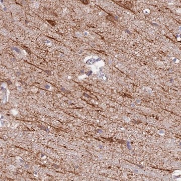 Anti-NEDD4 antibody produced in rabbit Prestige Antibodies&#174; Powered by Atlas Antibodies, affinity isolated antibody, buffered aqueous glycerol solution