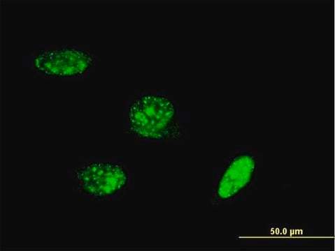 ANTI-PAX8 antibody produced in mouse clone 1A6, purified immunoglobulin, buffered aqueous solution