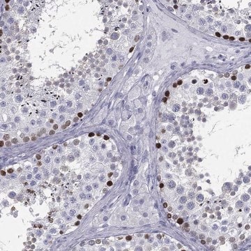 Anti-Esx1 Antibody Produced In Rabbit Prestige Antibodies&#174; Powered by Atlas Antibodies, affinity isolated antibody, buffered aqueous glycerol solution