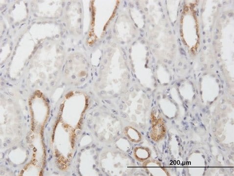 Anti-CAPS antibody produced in mouse purified immunoglobulin, buffered aqueous solution