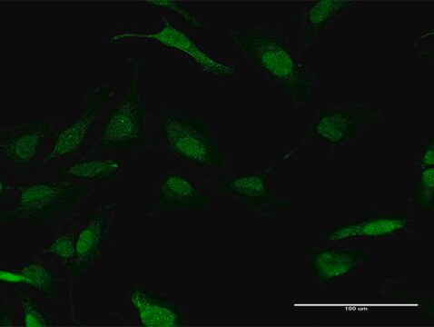 Anti-PPM1A antibody produced in mouse purified immunoglobulin, buffered aqueous solution