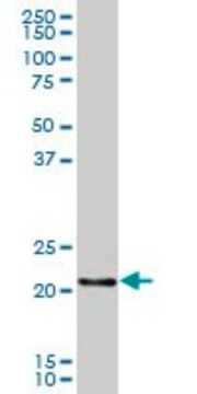 Anti-FLJ22655 antibody produced in mouse IgG fraction of antiserum, buffered aqueous solution