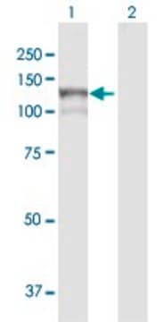 Anti-MAN2B1 antibody produced in rabbit purified immunoglobulin, buffered aqueous solution