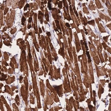 Anti-CTBP2 antibody produced in rabbit Prestige Antibodies&#174; Powered by Atlas Antibodies, affinity isolated antibody, buffered aqueous glycerol solution