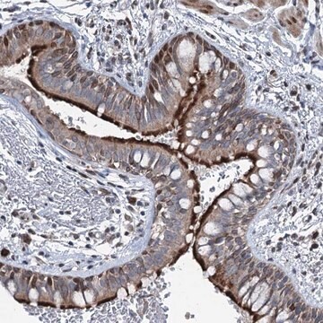 Anti-MRPL14 antibody produced in rabbit Prestige Antibodies&#174; Powered by Atlas Antibodies, affinity isolated antibody, buffered aqueous glycerol solution