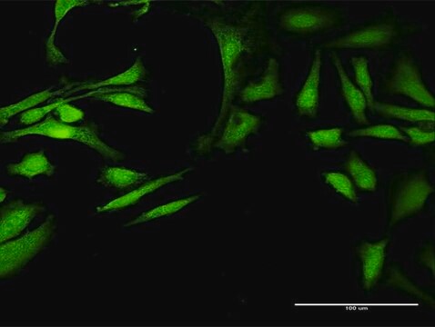 Anti-ALDH7A1 antibody produced in rabbit purified immunoglobulin, buffered aqueous solution