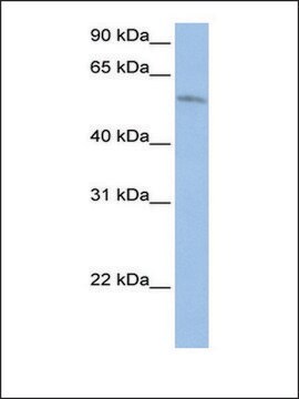 Anti-FAM20C (AB1) antibody produced in rabbit affinity isolated antibody