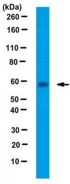 Anti-PKM1 Antibody serum, from rabbit