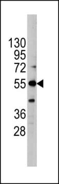 ANTI-ALKALINE PHOSPHATASE (ALPI) (CENTER antibody produced in rabbit IgG fraction of antiserum, buffered aqueous solution