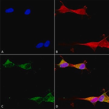 Monoclonal Anti-Ankyrin R-Horseradish Peroxidase antibody produced in mouse clone S388A-10