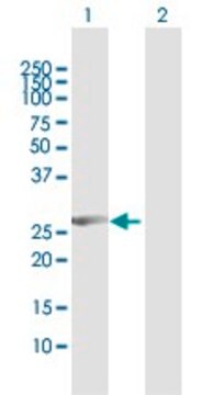 Anti-CCNB1IP1 antibody produced in rabbit purified immunoglobulin, buffered aqueous solution