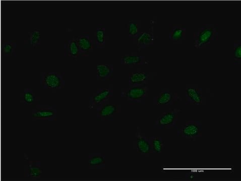 ANTI-HMX2 antibody produced in mouse clone 2D2, purified immunoglobulin, buffered aqueous solution