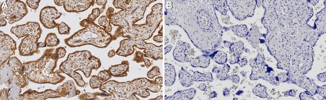 Anti-CARD8 Antibody, clone 1C23 ZooMAb&#174; Rabbit Monoclonal recombinant, expressed in HEK 293 cells