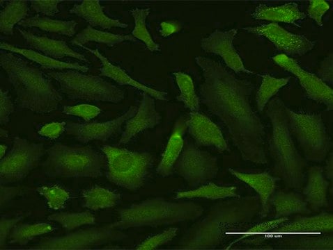 Anti-MALT1 antibody produced in rabbit purified immunoglobulin, buffered aqueous solution