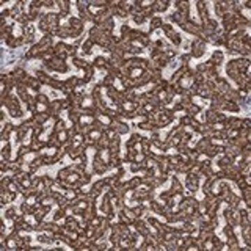 Anti-ALDH4A1 antibody produced in rabbit Prestige Antibodies&#174; Powered by Atlas Antibodies, affinity isolated antibody, buffered aqueous glycerol solution