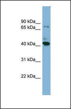 Anti-HERPUD2, (N-terminal) antibody produced in rabbit affinity isolated antibody