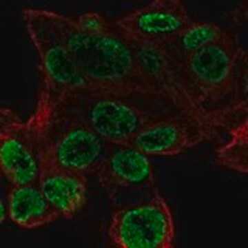 Anti-ODAM antibody produced in rabbit Prestige Antibodies&#174; Powered by Atlas Antibodies, affinity isolated antibody, buffered aqueous glycerol solution