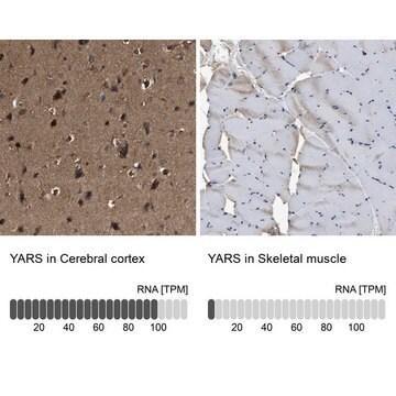 Anti-YARS antibody produced in rabbit Prestige Antibodies&#174; Powered by Atlas Antibodies, affinity isolated antibody, buffered aqueous glycerol solution