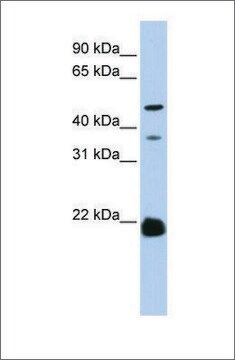 Anti-ZDHHC14 antibody produced in rabbit affinity isolated antibody