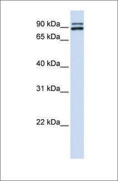 Anti-PCSK6 affinity isolated antibody