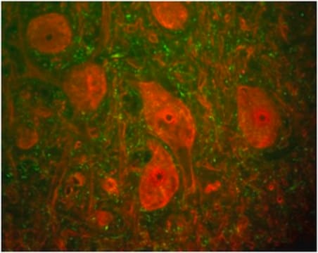 Anti-UCHL1 Antibody, clone MCA-BH7 clone MCA-BH7, from mouse