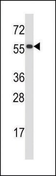 ANTI-PDIA2 (CENTER) antibody produced in rabbit IgG fraction of antiserum, buffered aqueous solution