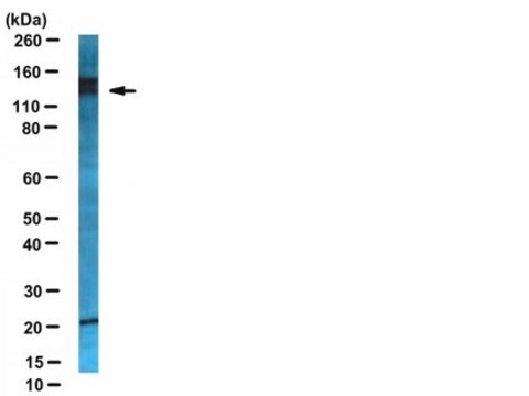 Anti-Neuropilin-2 Antibody serum, from rabbit