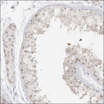 Anti-DYRK1B antibody produced in rabbit Prestige Antibodies&#174; Powered by Atlas Antibodies, affinity isolated antibody, buffered aqueous glycerol solution