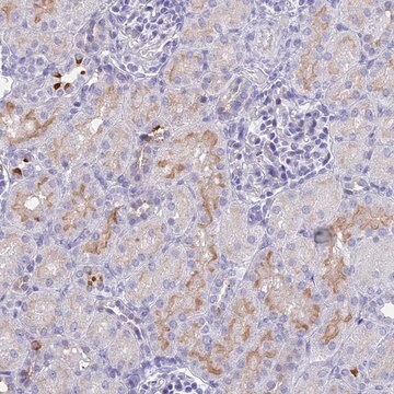 Anti-TMEM161B antibody produced in rabbit Prestige Antibodies&#174; Powered by Atlas Antibodies, affinity isolated antibody, buffered aqueous glycerol solution