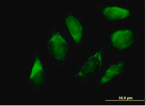 Anti-SERPINH1 antibody produced in mouse purified immunoglobulin, buffered aqueous solution