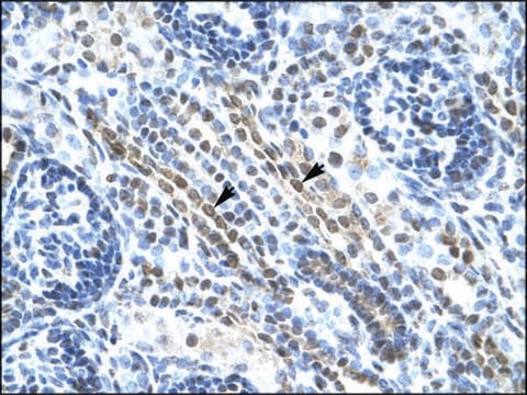 Anti-ANKRD11 antibody produced in rabbit IgG fraction of antiserum