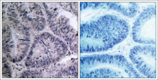 Anti-CHUK (Ab-23) antibody produced in rabbit affinity isolated antibody