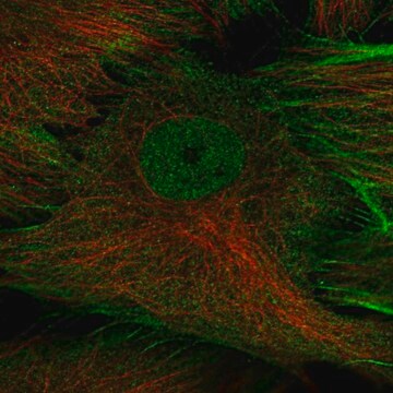 Anti-Tspan5 Antibody Produced In Rabbit Prestige Antibodies&#174; Powered by Atlas Antibodies, affinity isolated antibody, buffered aqueous glycerol solution