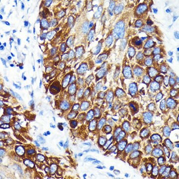 Anti-Cathepsin B Antibody, clone 6I5D7, Rabbit Monoclonal