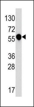 ANTI-IL1R (C-TERM E487) antibody produced in rabbit IgG fraction of antiserum, buffered aqueous solution