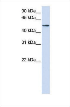 Anti-USP22 (ab2) antibody produced in rabbit affinity isolated antibody