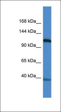 Anti-MYOCD antibody produced in rabbit affinity isolated antibody