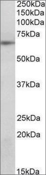 Anti-SOCS5 (N-terminal) antibody produced in goat affinity isolated antibody, buffered aqueous solution