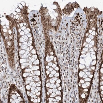 Anti-ECT2L antibody produced in rabbit Prestige Antibodies&#174; Powered by Atlas Antibodies, affinity isolated antibody, buffered aqueous glycerol solution