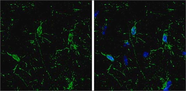 单克隆抗- Iba1 小鼠抗 clone GT10312, affinity isolated antibody