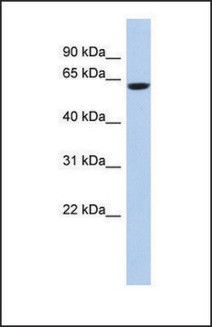 Anti-CAMKV, (N-terminal) antibody produced in rabbit affinity isolated antibody